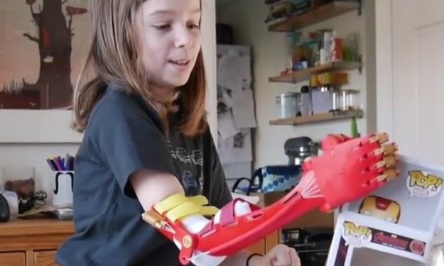 Prothese Kinder 3D Drucker